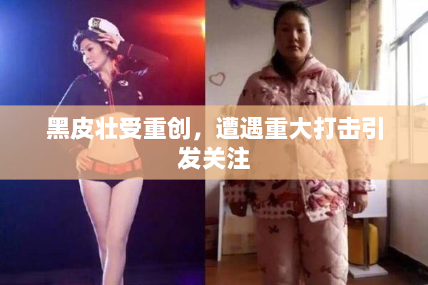 黑皮壮受重创，遭遇重大打击引发关注