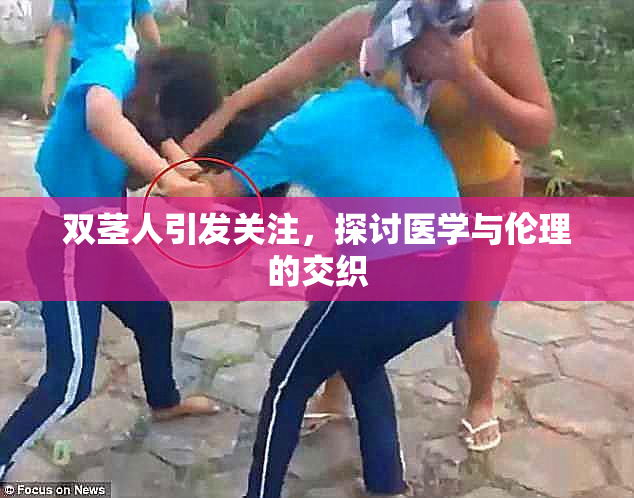 双茎人引发关注，探讨医学与伦理的交织