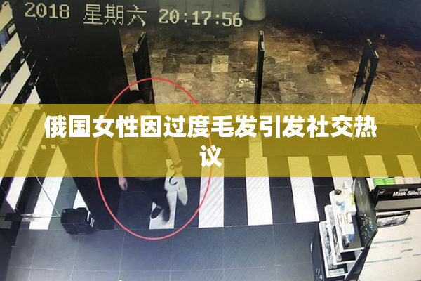 俄国女性因过度毛发引发社交热议