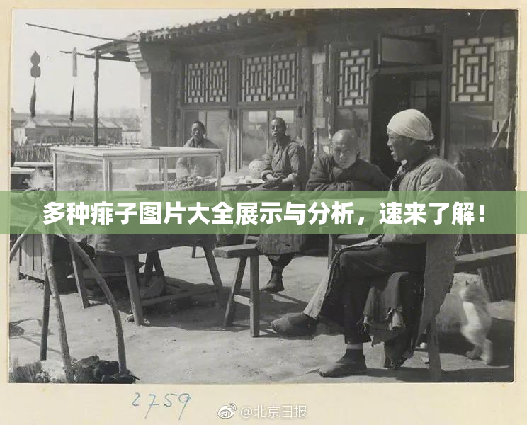 多种痱子图片大全展示与分析，速来了解！