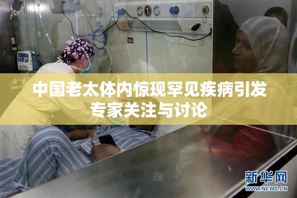 中国老太体内惊现罕见疾病引发专家关注与讨论