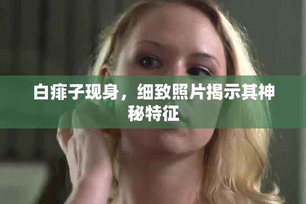 白痱子现身，细致照片揭示其神秘特征