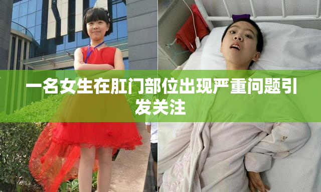 一名女生在肛门部位出现严重问题引发关注