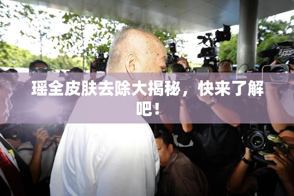 瑶全皮肤去除大揭秘，快来了解吧！