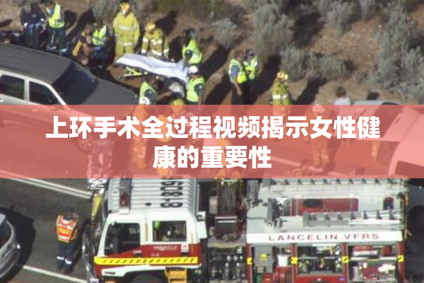 上环手术全过程视频揭示女性健康的重要性