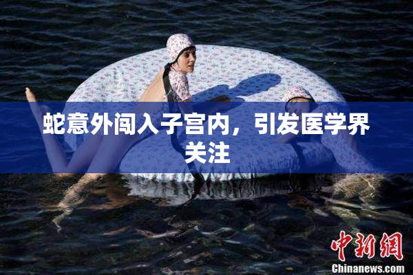 蛇意外闯入子宫内，引发医学界关注