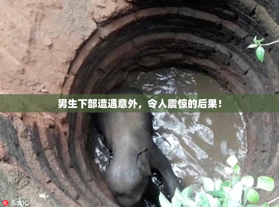 男生下部遭遇意外，令人震惊的后果！