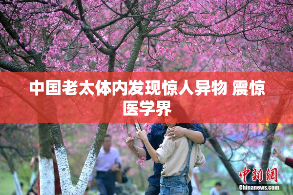 中国老太体内发现惊人异物 震惊医学界