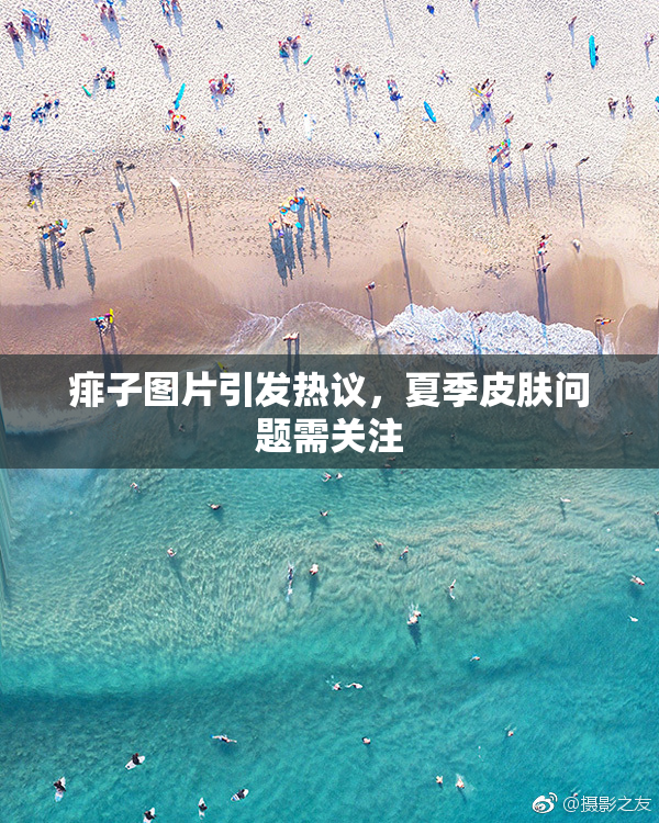 痱子图片引发热议，夏季皮肤问题需关注